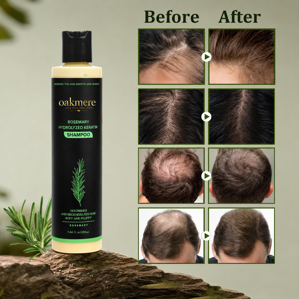 Oakmere® Rosemary Shampoo | Hair Growth & Scalp Treatment