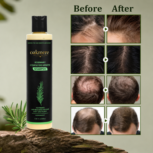 Oakmere® Rosemary Shampoo | Hair Growth & Scalp Treatment
